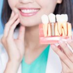 بهترین سن برای کاشت ایمپلنت دندان چه زمانی است؟
